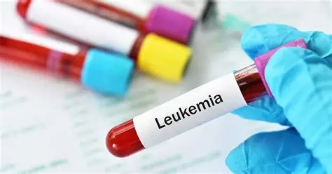 Leukemia لوسمی لوکمی